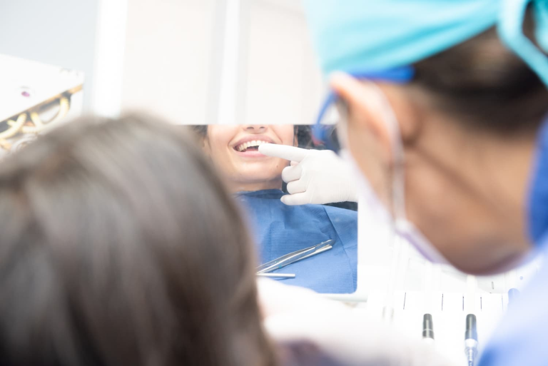 Faccette dentali: controindicazioni e cosa c’è da sapere