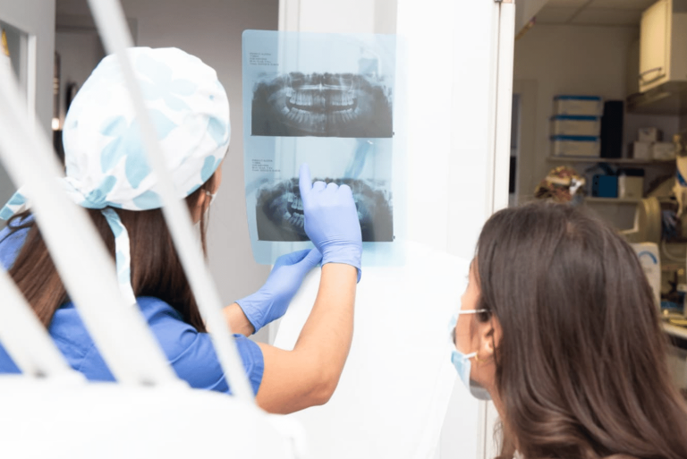 Denti rovinati dal fumo: come rimuovere le macchie