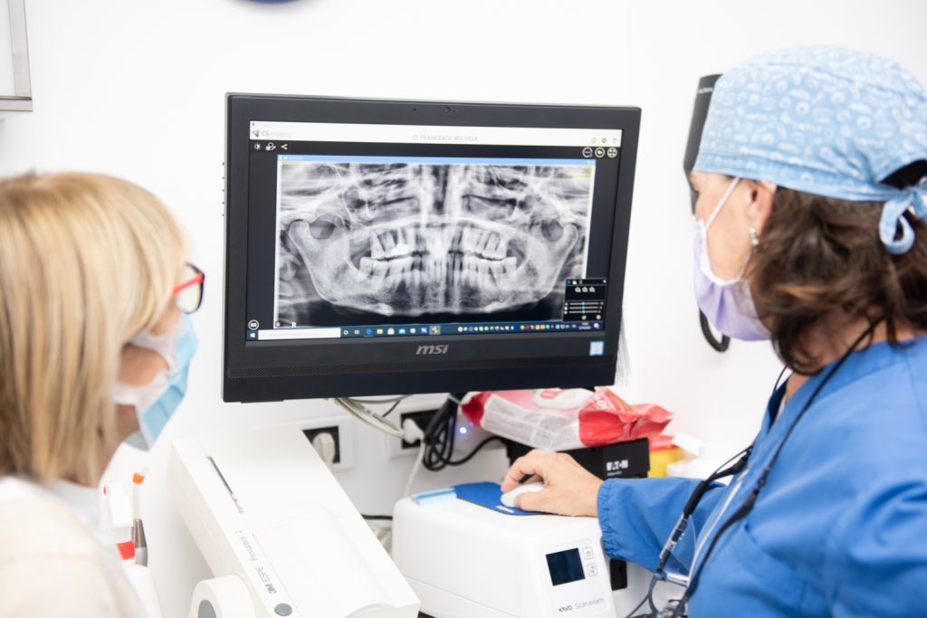 Implantologia dentale a Torino